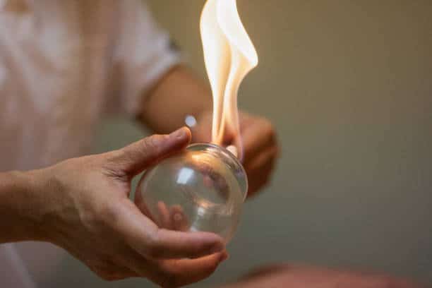 fire cupping