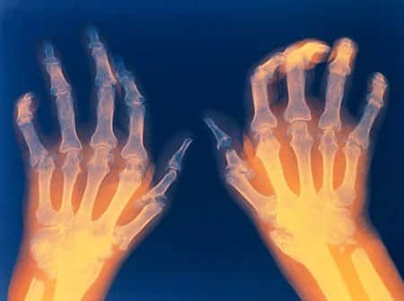 Physiotherapy The Best
