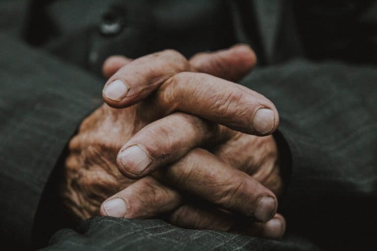 Arthritis in hands