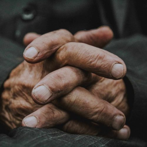 Arthritis in hands